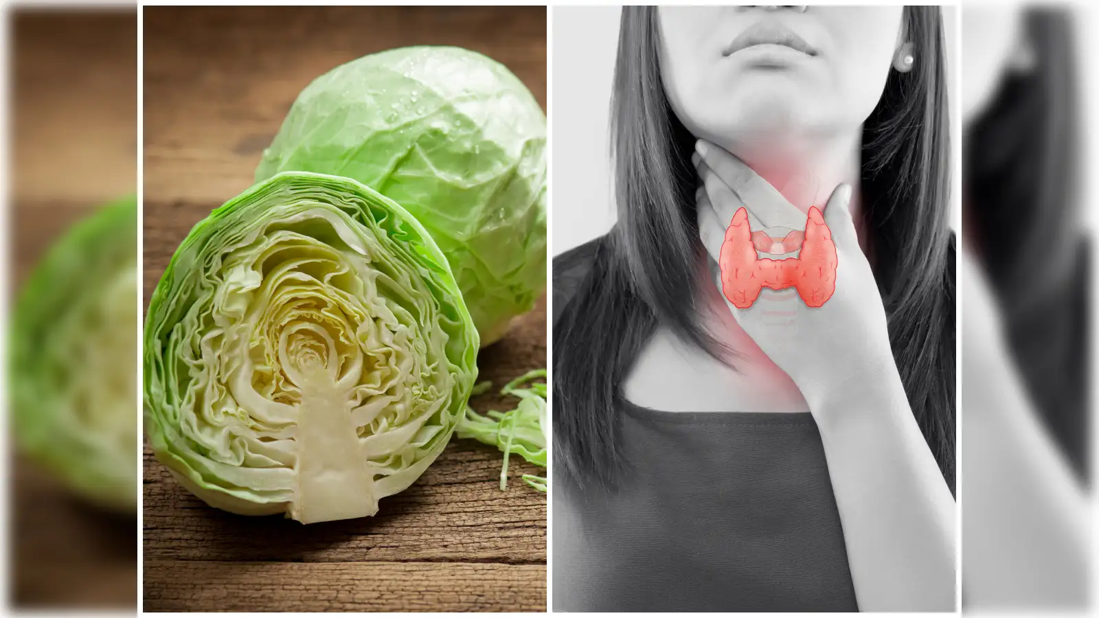 Thyroid Disease And Cabbage,തൈറോയ്ഡ് ഉള്ളവര് കാബേജ് കഴിച്ചാല് പ്രശ് ...