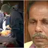 Hair Growth In Mouth,ക്യാൻസർ ശസ്ത്രക്രിയയ്ക്കുശേഷം വായിൽ രോമവളർച്ച ...