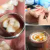 Home Remedies for Tooth Pain, Cavities, Dental Plaque Tartar and Bad ...