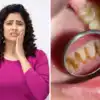Toothache Instant Relief 5 Effective Home Remedies For Tooth Pain ...