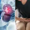 How To Do Kidney Function Test;बाहेर पडण्याची गरज नाही, घरच्या घरीच करा ...