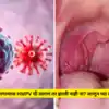 HMPV Virus Symptoms Know How To Protect - घसा दुखू लागल्यास HMPV ची ...