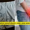 Reasons for rashes on a man private part in marathi, reasons for rashes ...