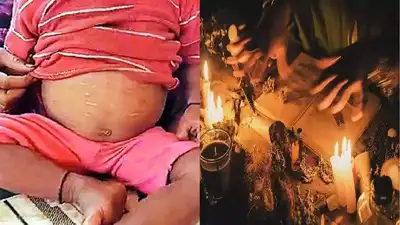 अंधश्रद्धेचा कळस! पोटच्या गोळ्याला गरम खुरप्याच्या डागण्या; आजार बरा करण्यासाठी मेळघाटात अघोरी प्रकार - aghori rituals performed on childrens to cure diseases in ...