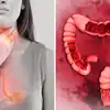 https://static.langimg.com/mt/thumb/125733913/to-get-rid-of-constipation-gas-acidity-and-bloating-in-winter-gastroenterology-doctor-shared-7-home-remedies.jpg?height=900&imgsize=1086082&resizemode=75&width=1600
