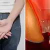 https://static.langimg.com/mt/thumb/126603407/piles-causes-symptoms-signs-and-remedies-what-to-eat-and-what-to-avoid-in-hemorrhoids.jpg?height=900&imgsize=994091&resizemode=75&width=1600
