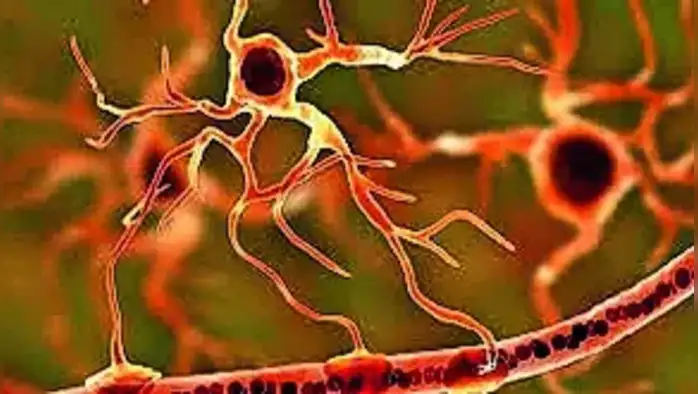 नवज्ञात ग्लिमफॅटिक संस्था नवज्ञात ग्लिमफॅटिक संस्था