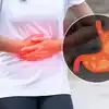These 6 Causes Are Responsible For Stomach Sound Or Bloating And ...