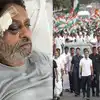 Congress Leader Nitin Raut Injured While Walking With Rahul Gandhi ...