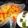 5 Ayurvedic Herbs to Clean Your Liver Naturally; लिव्हरमध्ये साचलेल्या ...