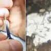 Microscopic Video Of Nails,माइक्रोस्कोप से नाखूनों के अंदर का हाल देख ...