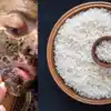 Can Rice Remove Hyperpigmentation,रात के चावल बचे हैं? 4 देसी चीजें ...