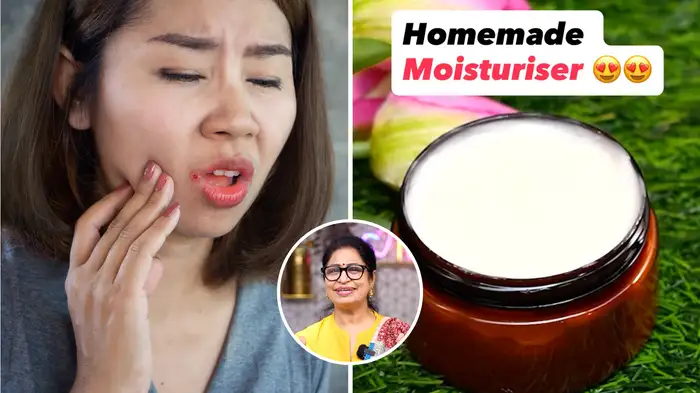 home made cream for skin home made cream for skin