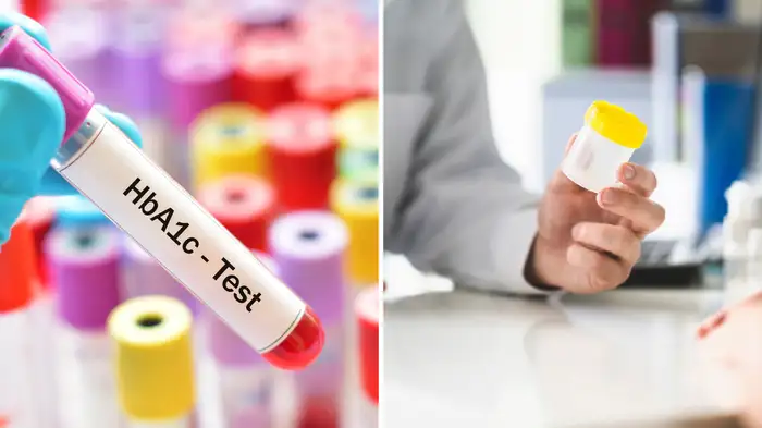 test for diabetic patient test for diabetic patient