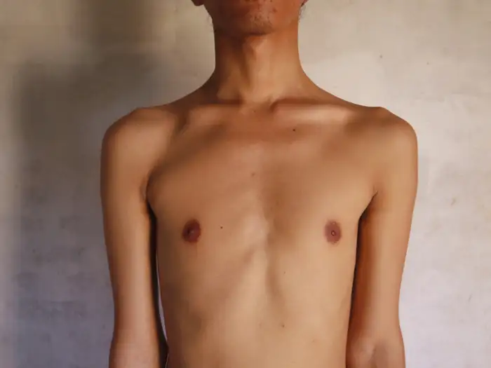 दूसरा बड़ा कारण है ये