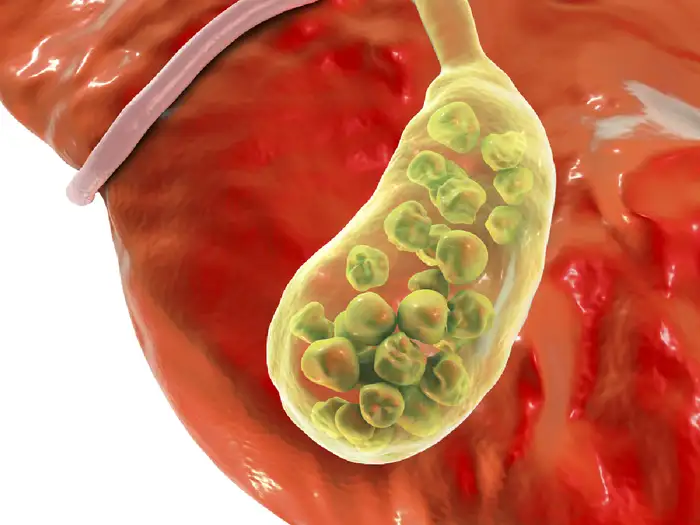 सूजन और संकुचन कम होना