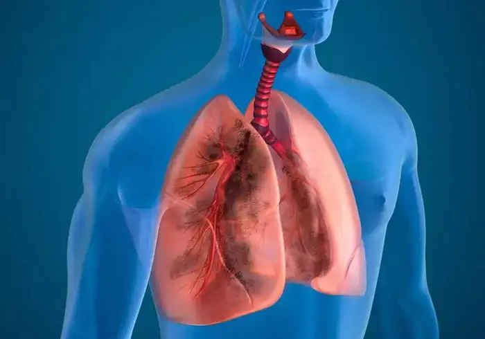 आवाज में बदलाव के कारण 