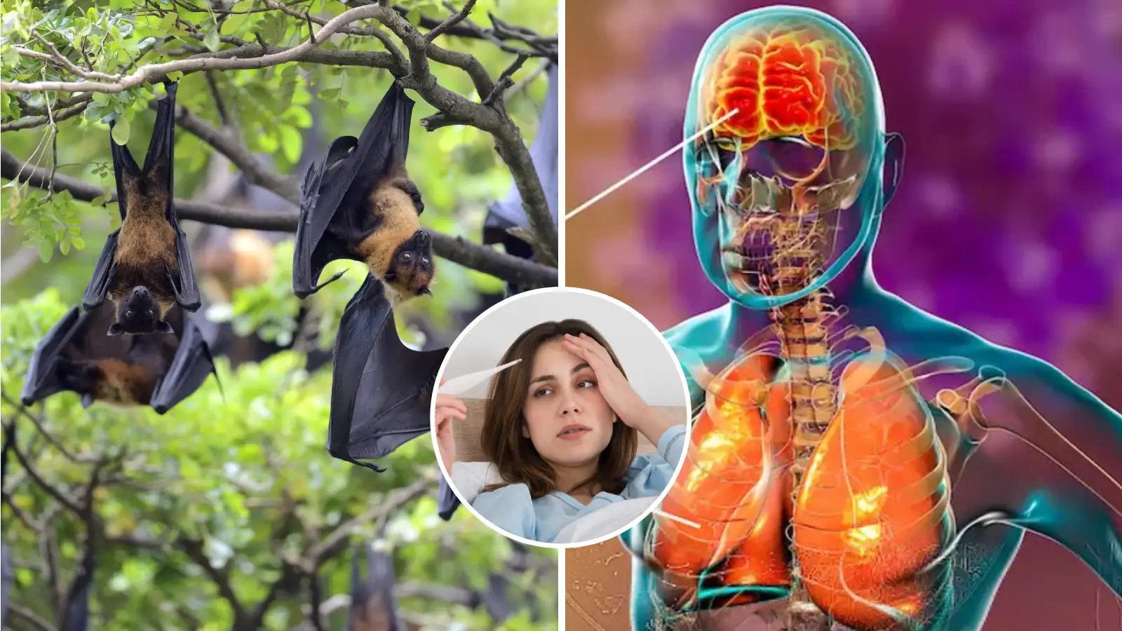 पश्चिम बंगाल में निपाह वायरस के 5 केस की रिपोर्ट: लक्षणों की पहचान और बचाव पर बढ़ी सतर्कता