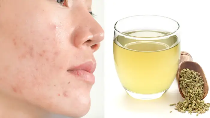 fennel water for glowing skin fennel water for glowing skin