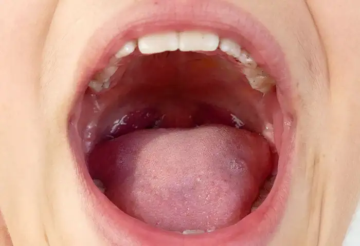 mouth oral tongue teeth