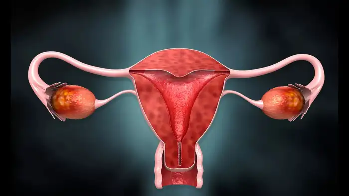 ovarian cancer signs ovarian cancer signs