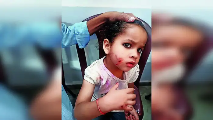 सपना कॉलोनी में बंदर ने दौड़ाकर बच्ची को काटा सपना कॉलोनी में बंदर ने दौड़ाकर बच्ची को काटा