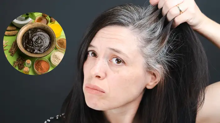 white hair ayurveda treatment white hair ayurveda treatment