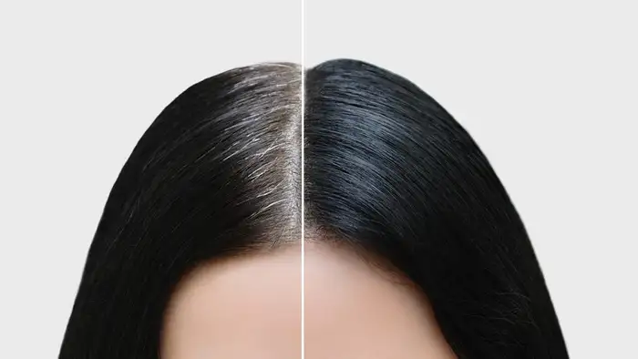 white hair ayurveda treatment possible