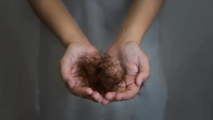 post delivery hair loss<br>