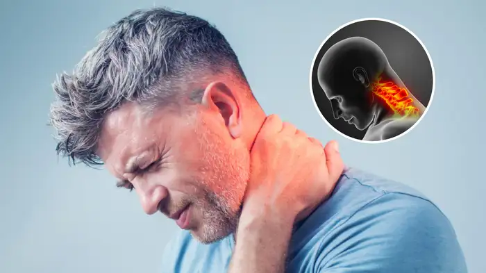 neck pain cervical spondylosis neck pain cervical spondylosis