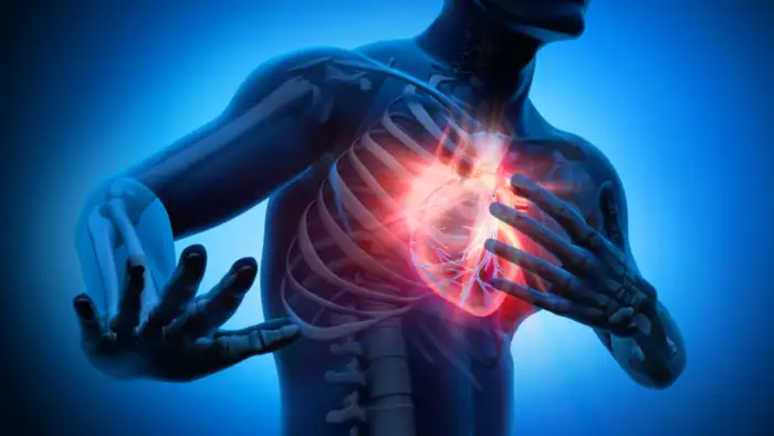 heart attack 3d illustration
