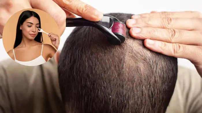 derma rolling at home pros and cons derma rolling at home pros and cons