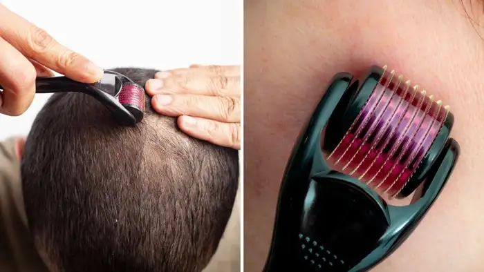 derma rolling benefits for skin and hair