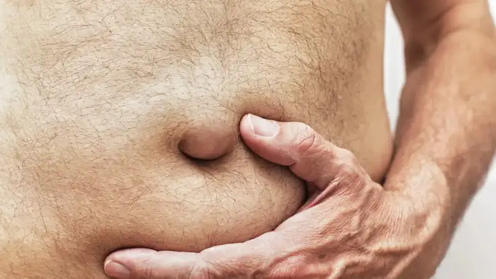 hernia men stomach