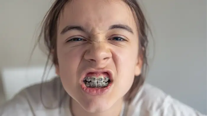 want to fix your childs crooked teeth get braces at the right age for best results want to fix your childs crooked teeth get braces at the right age for best results