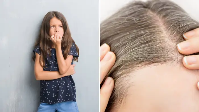 why are kids getting grey hair early stress and 2 key factors could be the reason know the solutions (2) why are kids getting grey hair early stress and 2 key factors could be the reason know the solutions (2)