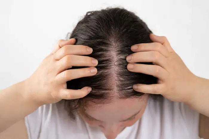बच्चों में सफेद बालों की समस्या बढ़ी