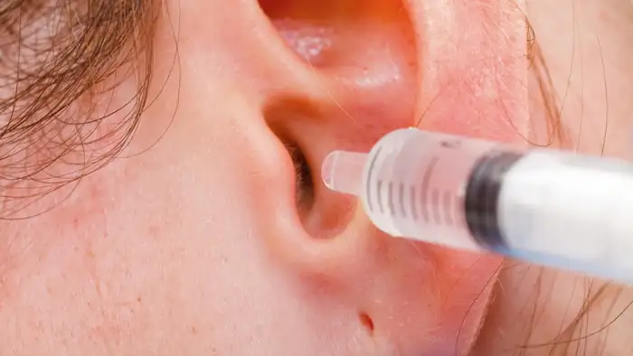 ear wax removal at clinic