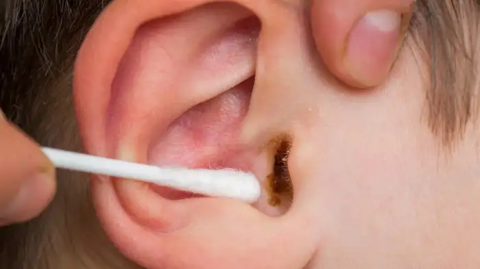 ear wax removal ear wax removal