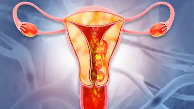 What Is Abnormal Vaginal Bleeding,पीरियड्स के बिना हेवी ब्लीडिंग किन रोगों  का संकेत है, महिलाओं को किन स्थितियों में अलर्ट हो जाना चाहिए - non  menstrual abnormal vaginal ...