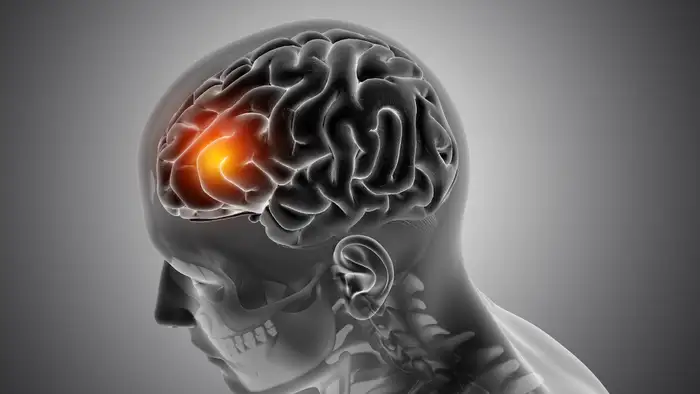 sleep apnea impact your brain
