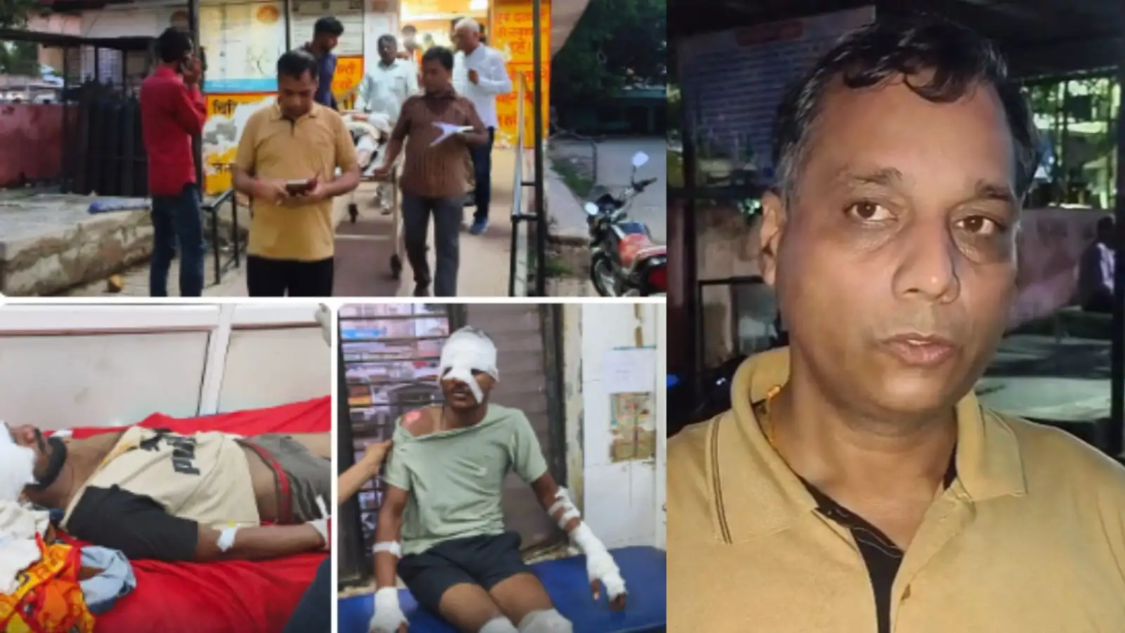 हाथरस में मथुरा-बरेली हाईवे पर डाक कांवड़ को कार ने मारी टक्कर, दो कांवड़िया गंभीर घायल