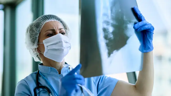 Dry cough can be sign of IPF <br>