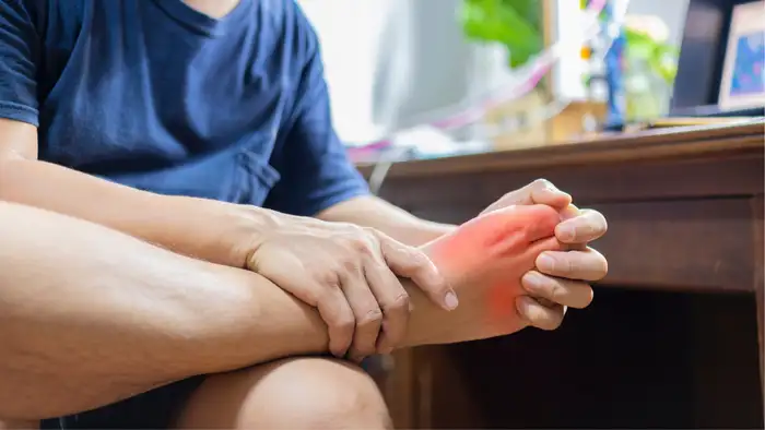 can uric acid causes pain while walking