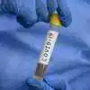 Corona Test Swab Price In India brought down to one tenth - कोरोना ...