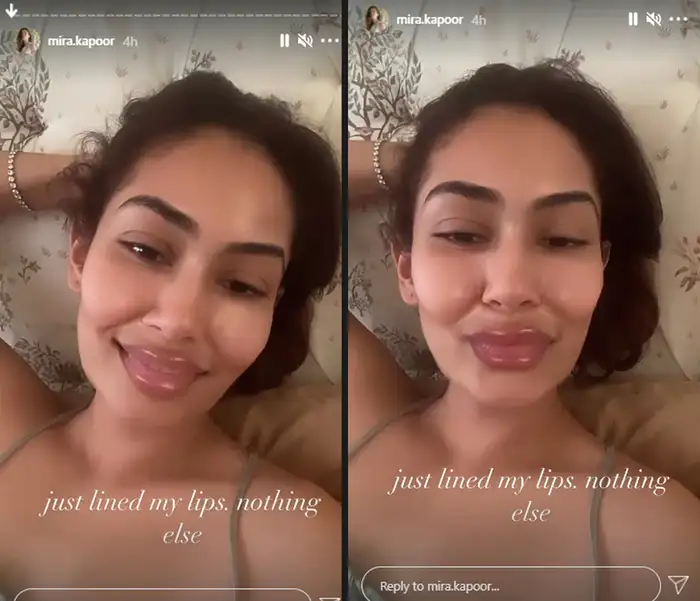 Shahid Kapoor wife Mira Rajput Lip Fillers videos goes viral on ...