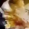 Boiling Soup Explodes On Waitresss Face As She Tries To Retrieve ...