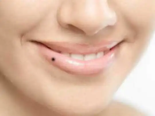 meaning mole on lips til hoto per kya hai meaning