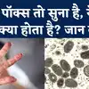 All you need to know about Monkeypox Virus: In which countries has ...