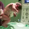 Lotus Birth,लोटस बर्थ से करवाई डिलीवरी तो बच्‍चे को हो सकता है इंफेक् ...